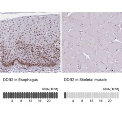 XPE/DDB2 Antibody, Novus Biologicals 25 &mu;L, Unlabeled:Antibodies, Polyclonal
